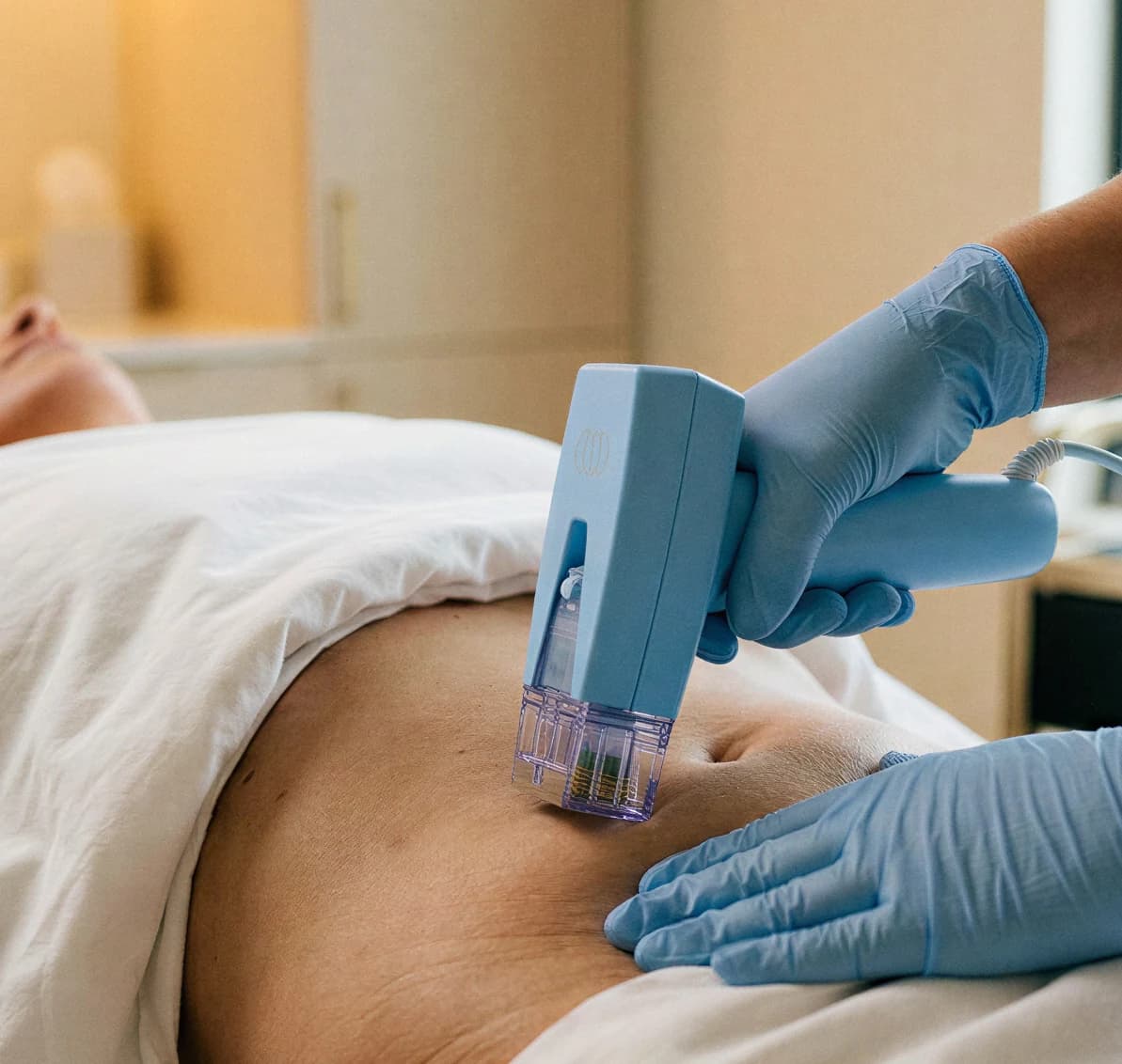 A clinician in blue gloves running a body contouring handpiece over a reclined patient's abdomen