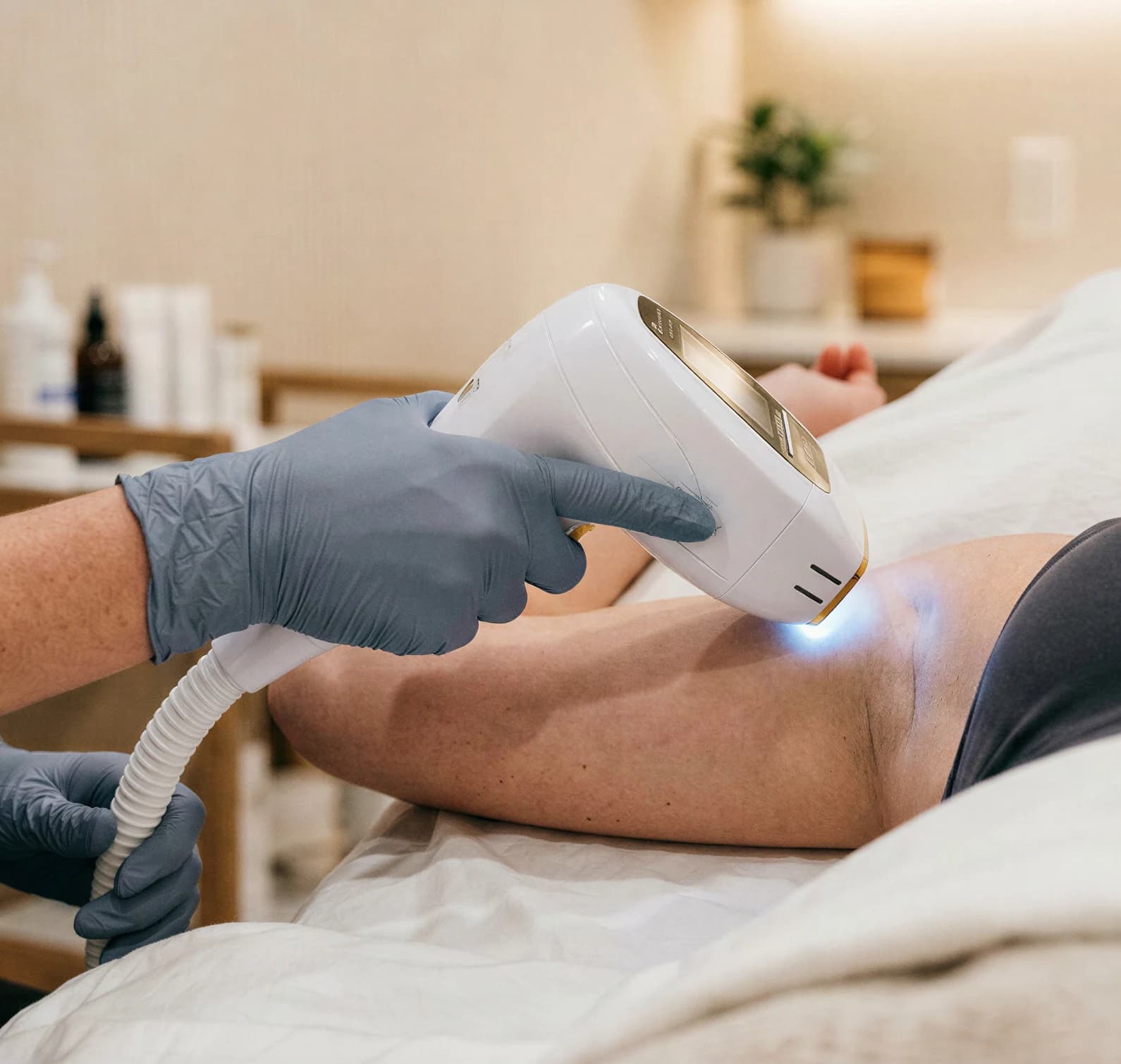A clinician performing laser hair removal on a patient's underarm with a handheld device