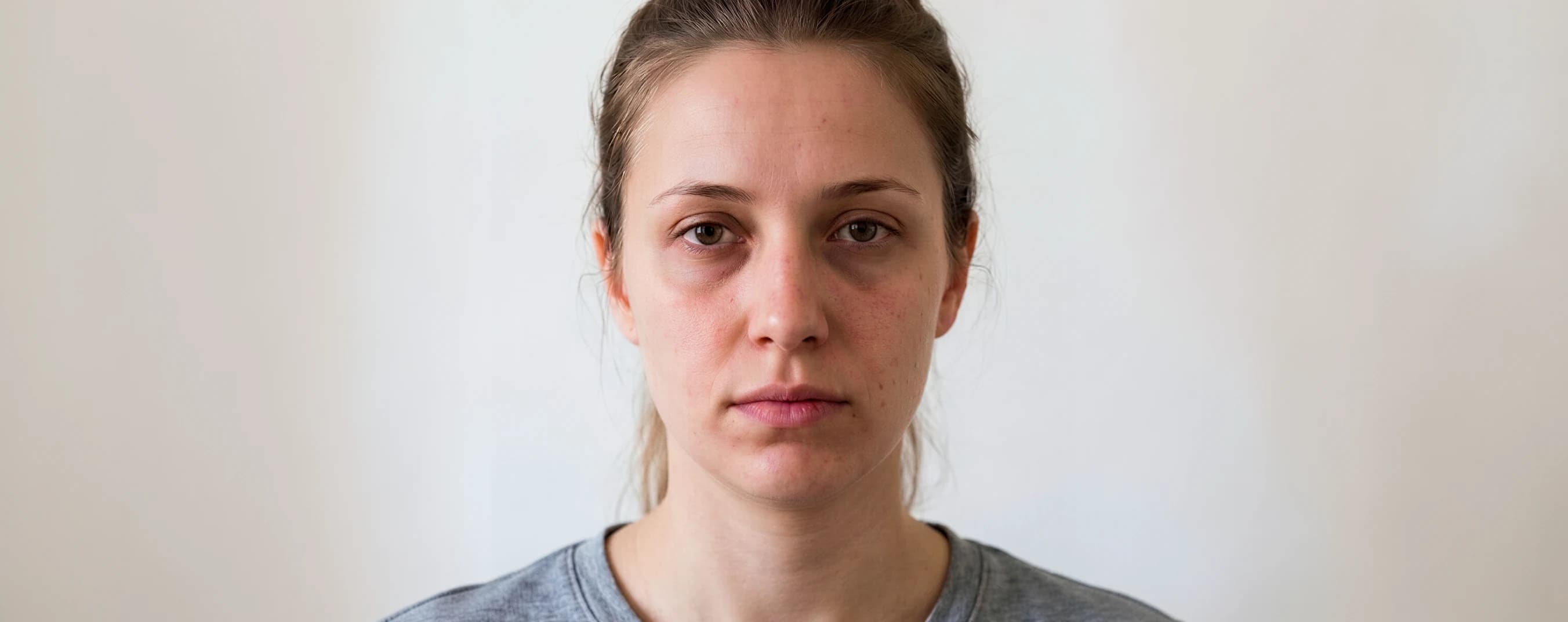Under-Eye Brightening & Facial Radiance — before