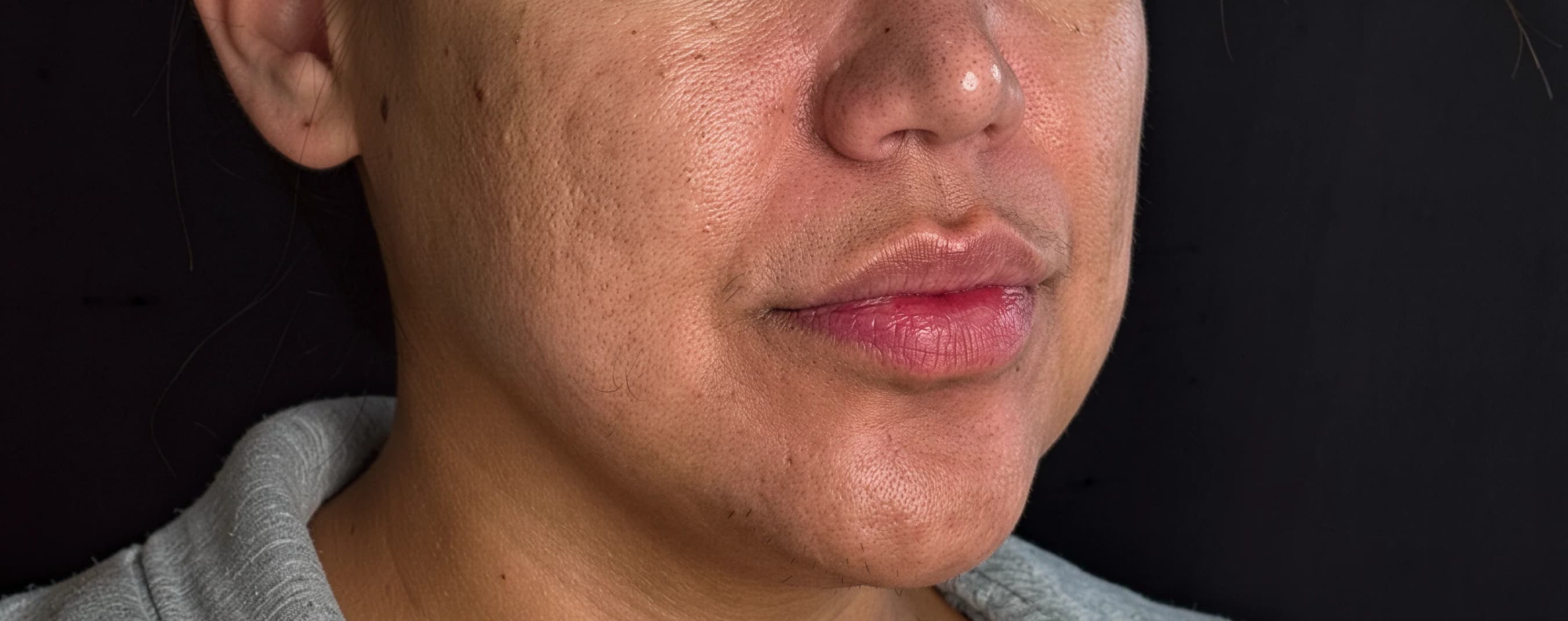 Facial Glow & Hydration — before